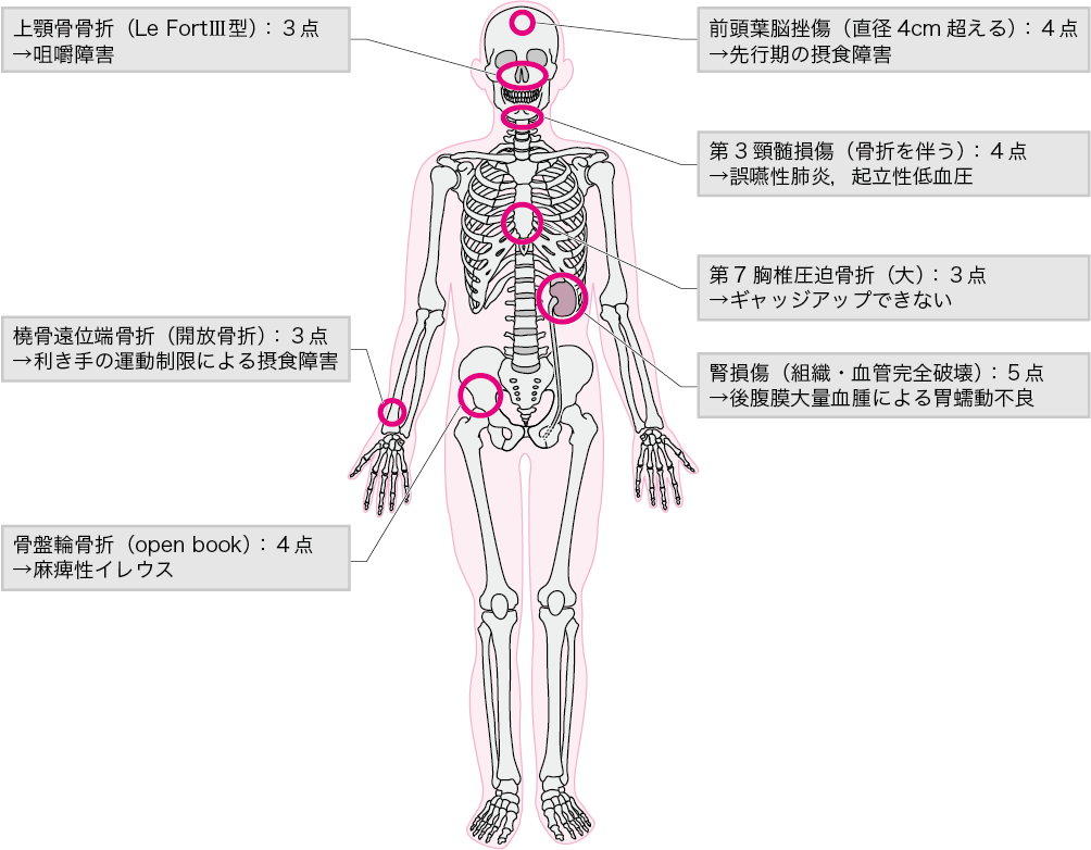 第10章 10-3：多発外傷 | ニュートリー株式会社