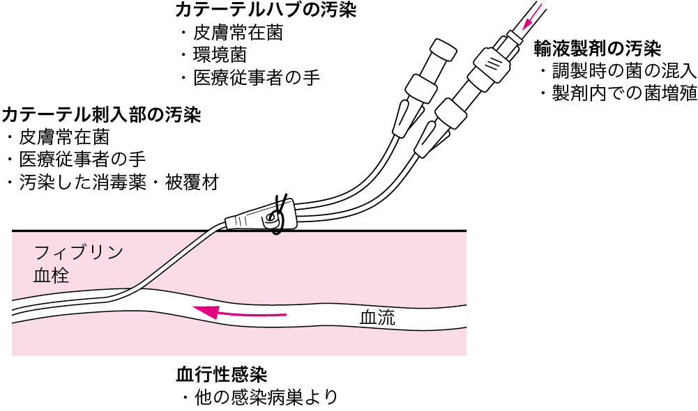 図Ⅱ