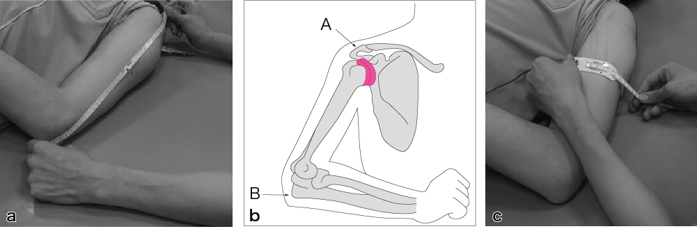 図1●上腕周囲長（arm circumference：AC）の測定法