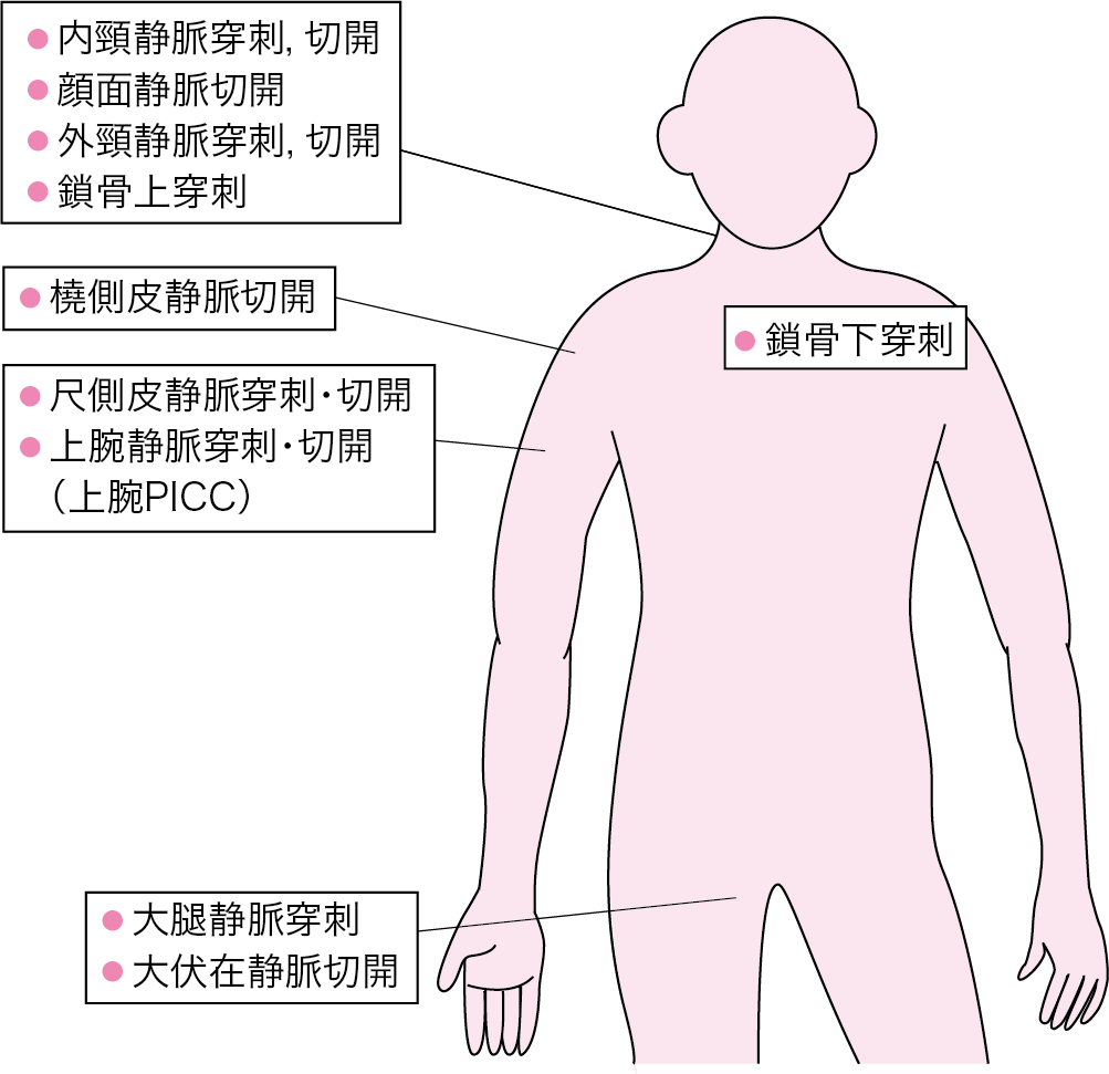 第9章 9 2 中心静脈カテーテル ニュートリー株式会社