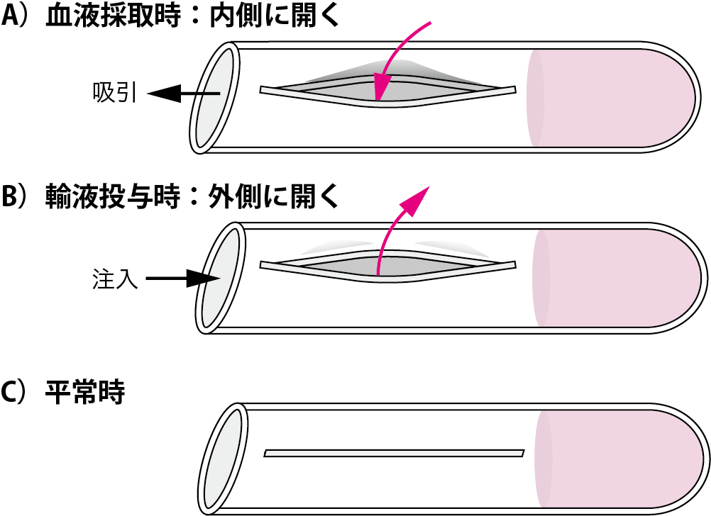 図9●Groshongタイプカテーテル