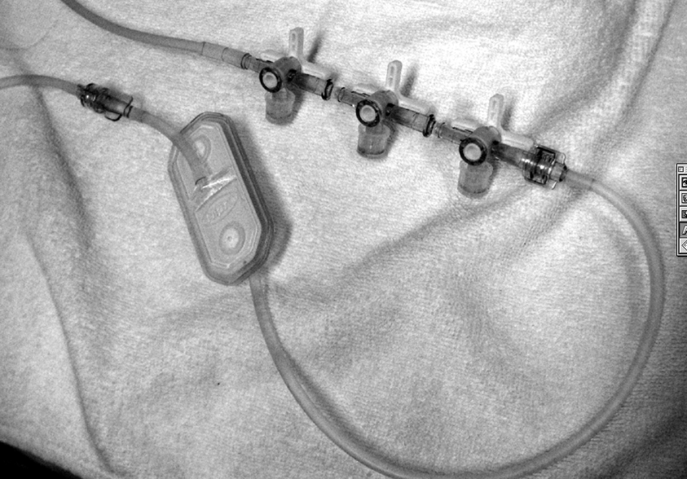  図19●中心静脈輸液ラインにおける三方活栓の使用