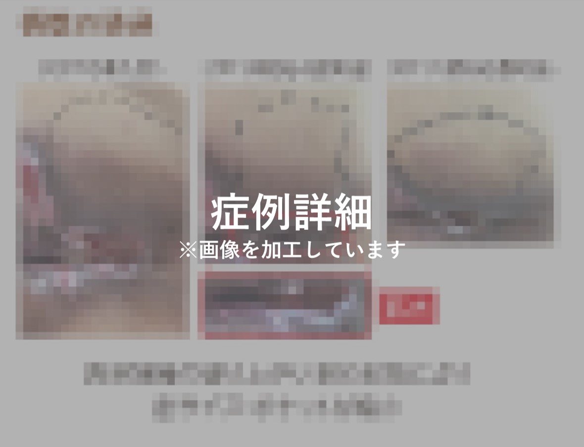 60_0136_症例1ぼかし.jpg