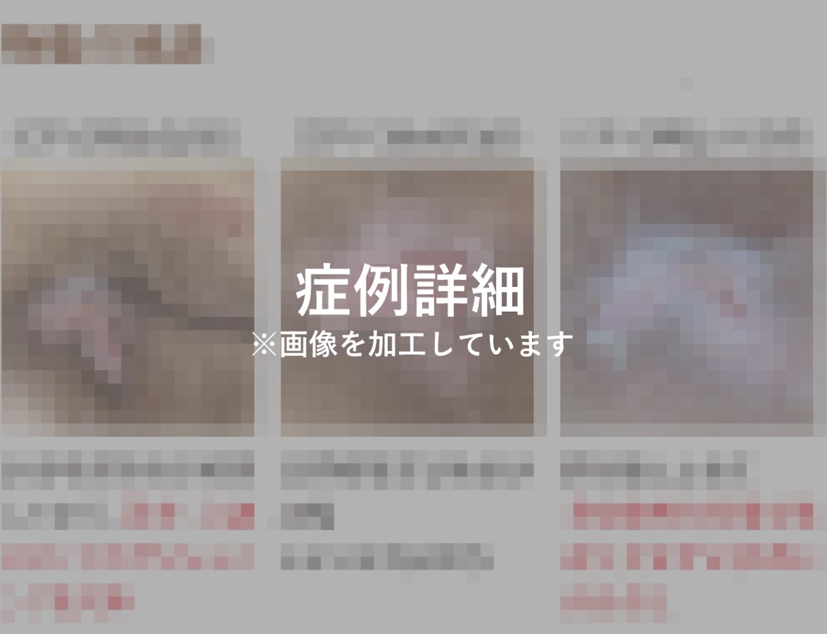60_0136_症例3ぼかし.jpg